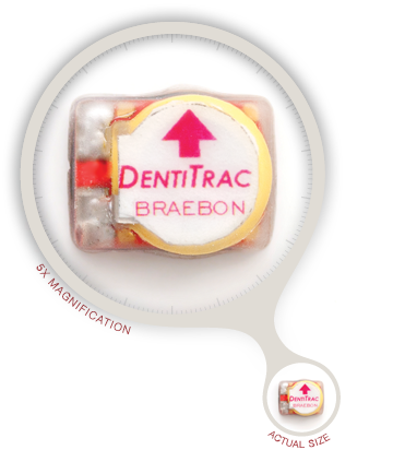 DentiTrac