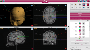 3 ROSA Software