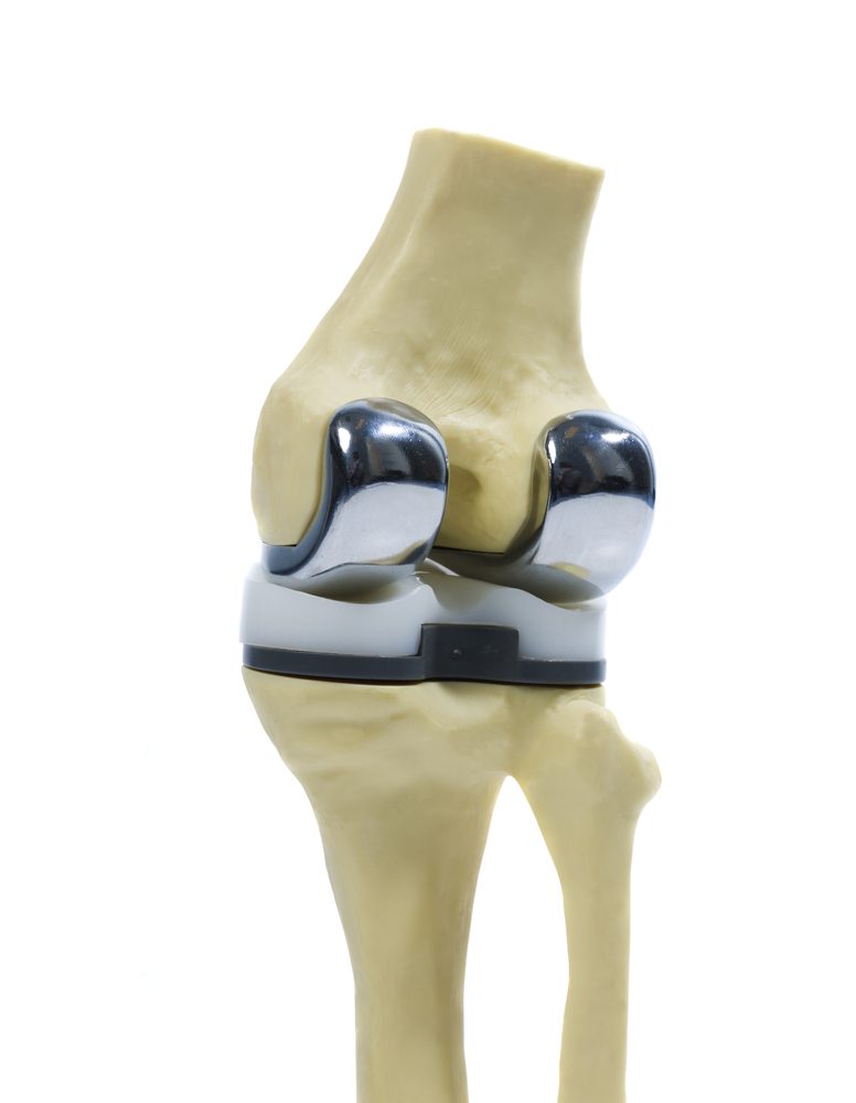 AsahiKlin Artificial Knee