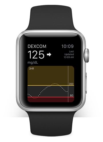 Dexcom Apple Watch