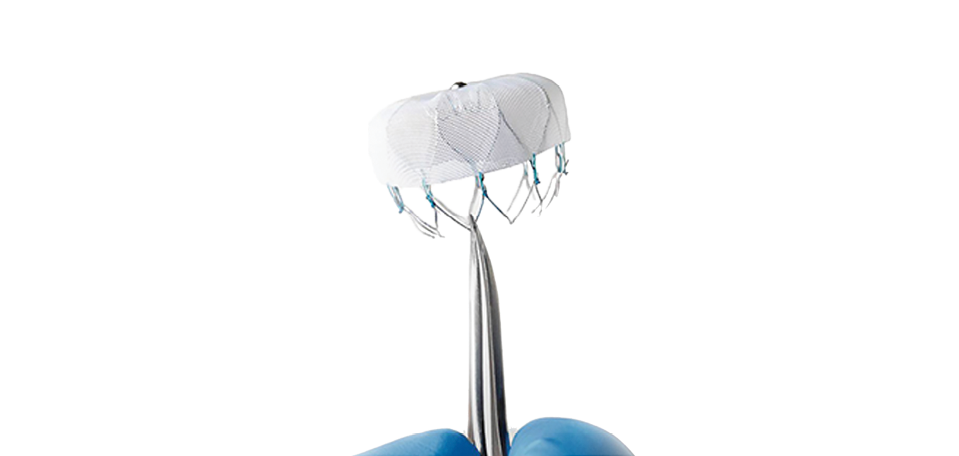 Understanding nitinol implant design and manufacturing Medical Design