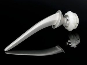Stainless steel and ultra high molecular weight polythene hip replacement
