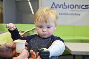 ambionics prosthetic arm