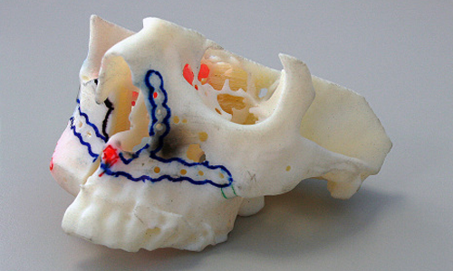 3d printed human jaw