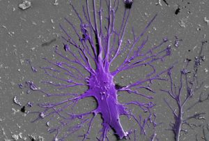 podocyte cells kidney filtration on a chip