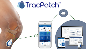 Consensus Orthopedics TracPatch DeviceLab 