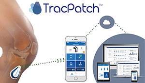 Consensus Orthopedics TracPatch DeviceLab