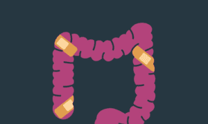 hydrogels repair intestines
