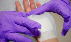 Flexcon Dermaflex