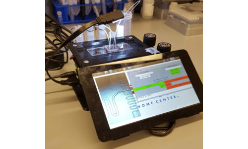 microfluidic device for rheumatoid arthritis