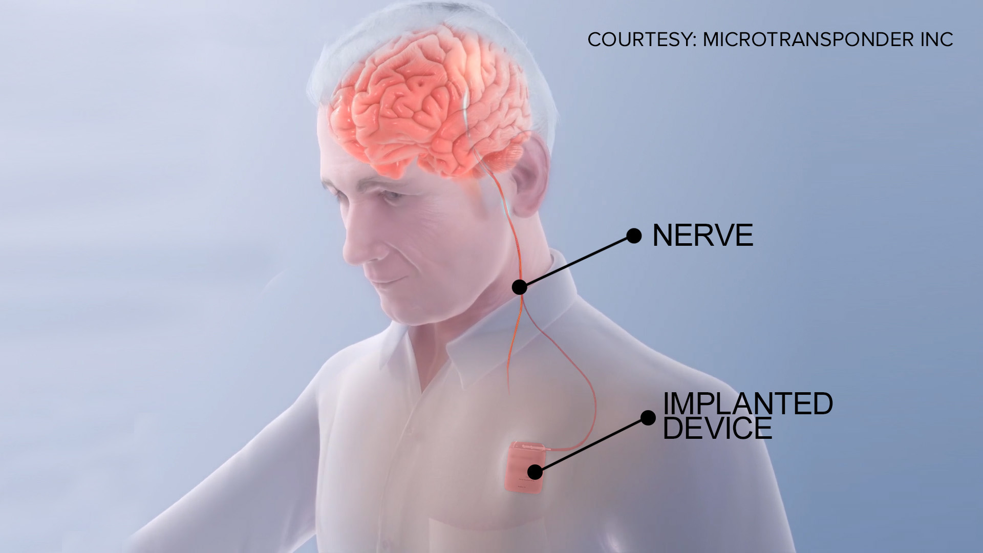 OSU-nerve-stimulation