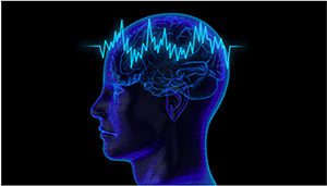 EEG brain neurostim
