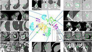 NIH cancer detection