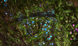 SLAM microscopy