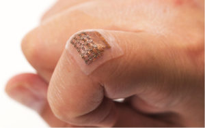 ultrasound blood pressure patch