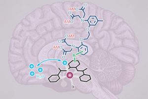 MIT-Calcium-MRI_0