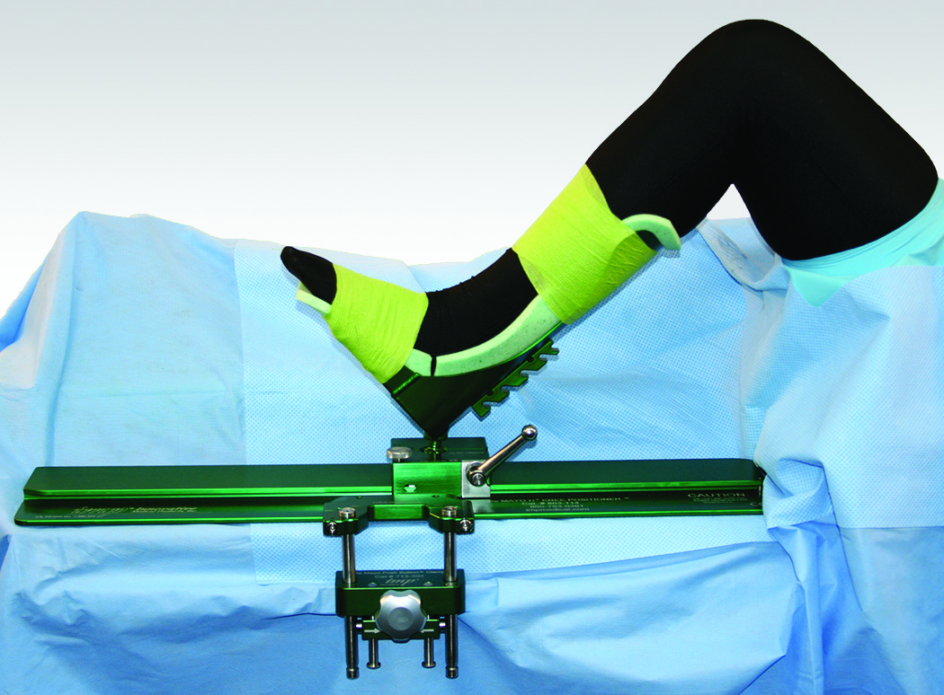 Innovative Medical Products Improves De Mayo D2 Knee Positioner With