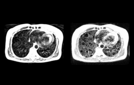 nih-siemens-new-MRI