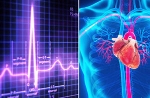 FDA-approved devices for treating the heart cardiology