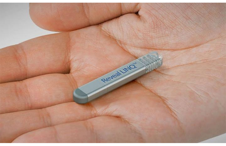 Medtronic implant found better at predicting AFib than external device ...