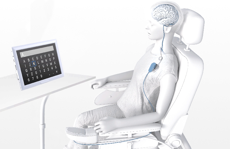 Catheter delivery could enable better brain implants: Synchron’s neuroscience chief explains how