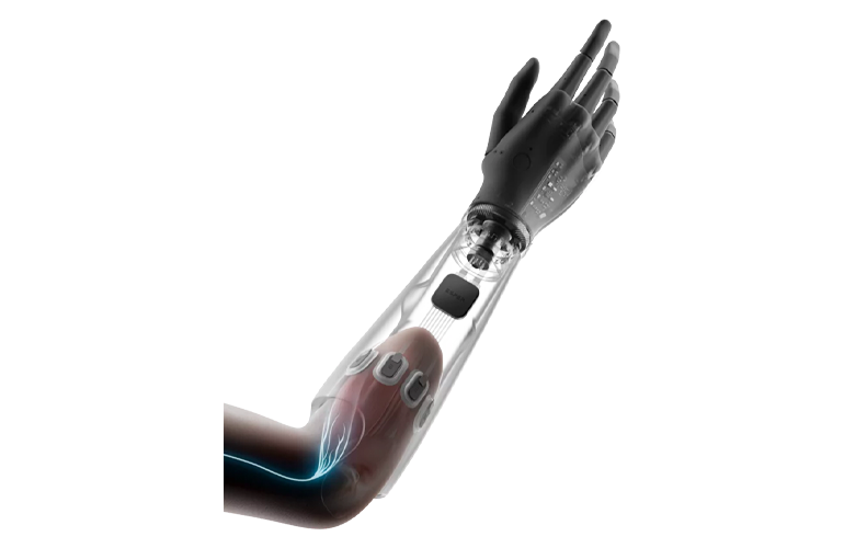 Esper Bionics Esper Hand