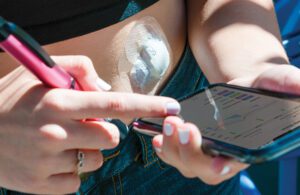 A patient wearing a continuous glucose monitor and reading the results on a smartphone while holding a smart insulin pen