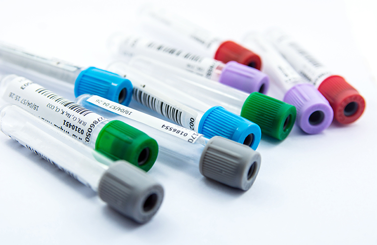 BD explores plastic blood tube recycling(03)