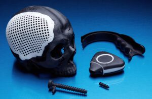 A 3d-printed cranial implant prototype designed by BTech Innovation.