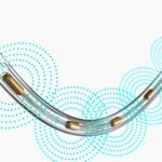 An illustration of the Boston Scientific's EkoSonic Endovascular System (EKOS).