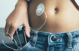 A photo of a wearable medical device stuck to a patient's skin with silicone adhesive.