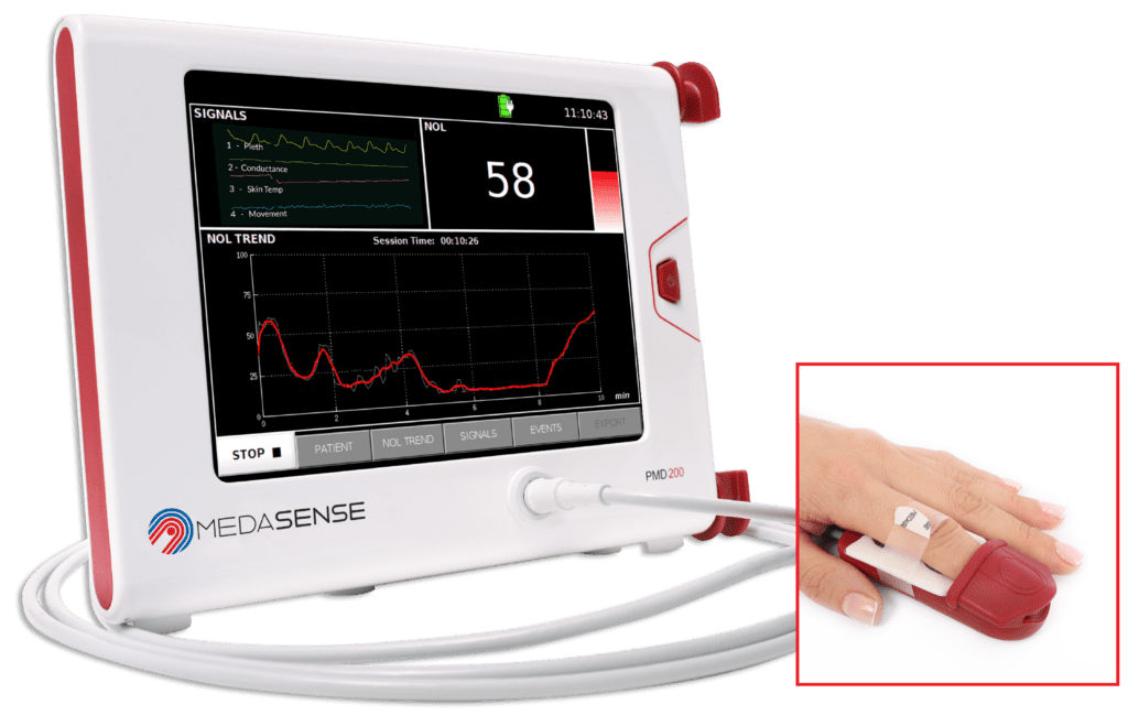 Medasense's pain monitoring solution for the operating room