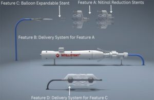 An illustration showing Heartpoint Global's IntelliStent catheter delivery system, nitinol reduction stents and balloon expandable stent. 