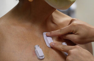 A photo of a wireless, wearable device that has microphones to monitor body sounds inside of a patient.