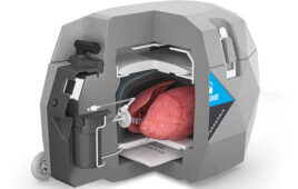 A cutaway illustration showing the interior of the Paragonix Baroguard system for transporting donor lungs.