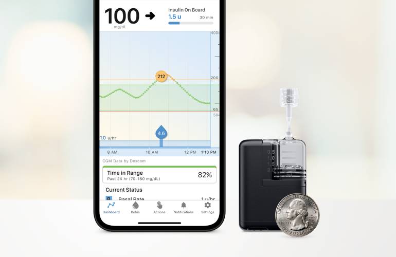 Tandem-Mobi-Insulin-Pump-with-App