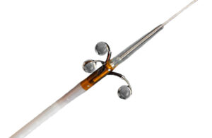 The Ablative Solutions Peregrine infusion catheter with alcohol coming out of its three nitinol microneedles.