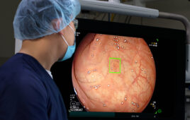 A photo of the Medtronic GI Genius ColonPro polyp detection system flagging a potential sign of colon cancer during a colonoscopy. [Photo courtesy of Medtronic]