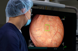 A photo of the Medtronic GI Genius ColonPro polyp detection system flagging a potential sign of colon cancer during a colonoscopy. [Photo courtesy of Medtronic]