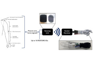 An image showing components of the Blue Arbor Technologies Restore Neuromuscular Interface System