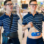 Two side-by-side photos of Medtronic Endoscopy Chief Medical Officer Dr. Austin Chiang wearing the link device for the latest-generation PillCam and the previous generation's wearable recorder.