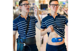 Two side-by-side photos of Medtronic Endoscopy Chief Medical Officer Dr. Austin Chiang wearing the link device for the latest-generation PillCam and the previous generation's wearable recorder.