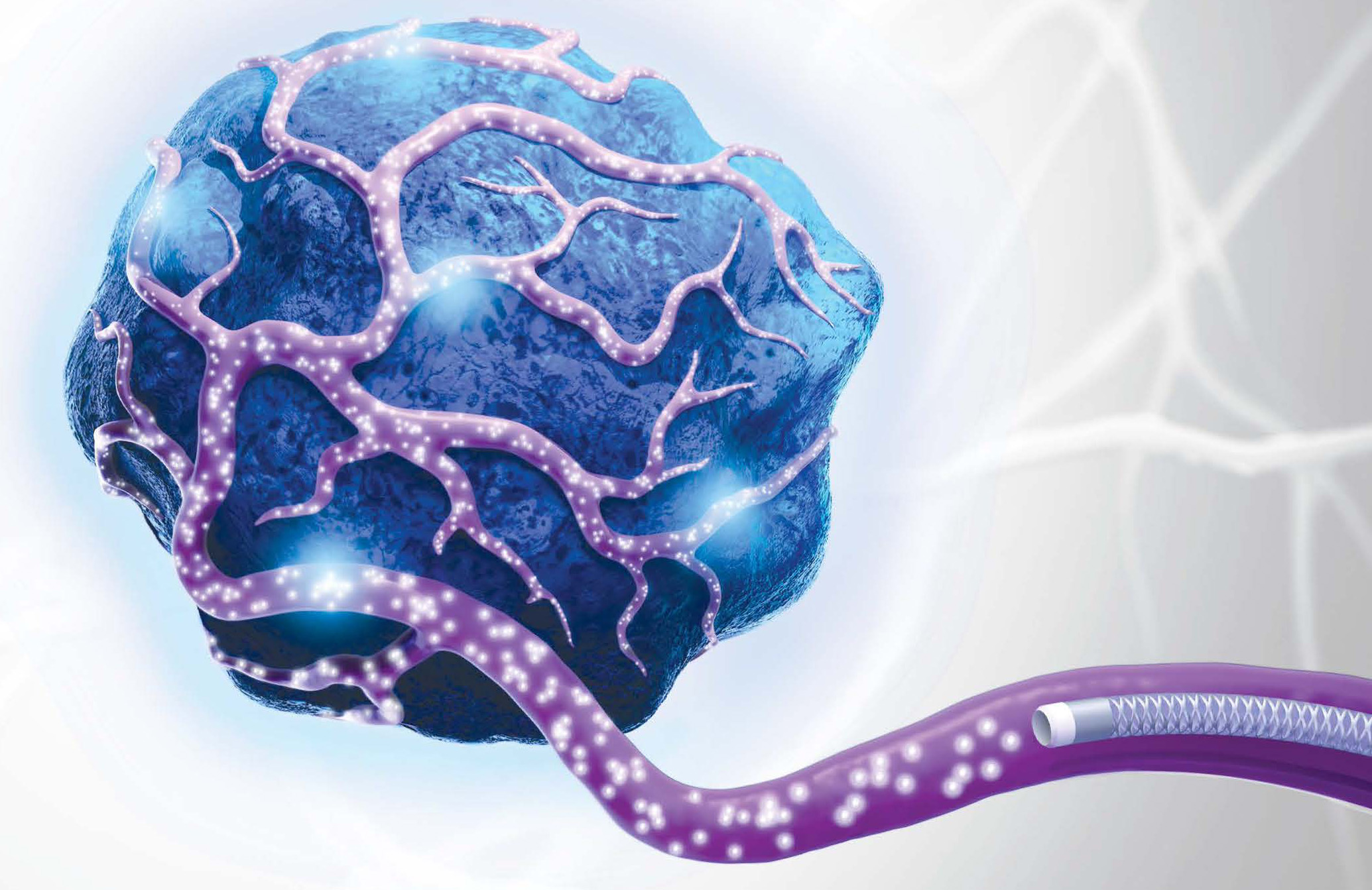 How Boston Scientific's tiny, radioactive TheraSpheres kill cancer