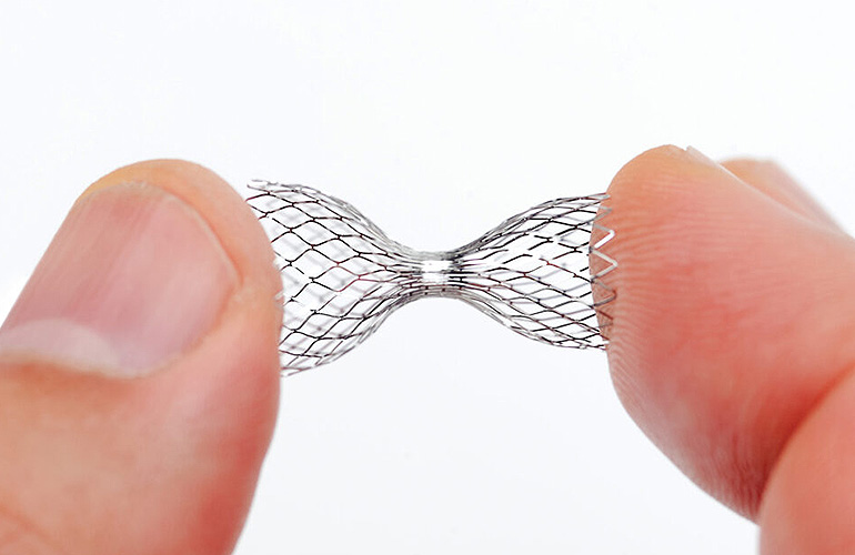 A photo showing the Shockwave Reducer implant for refractory angina being held between two fingers.