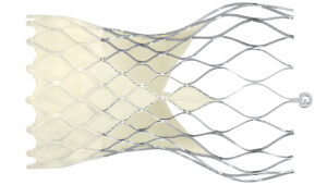 An image of the The Medtronic Evolut Pro.