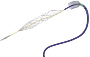 An illustration of Inari Medical's Artix MT mechanical thrombectomy catheter and Artix Thin-Walled Thrombectomy Sheath.