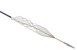 An image showing Inari Medical's Artix MT mechanical thrombectomy catheter.