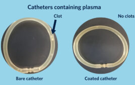 An image showing two catheters, one with a clot and another (treated with the new coating) without any clots.