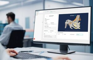 Axial3D GE HealthCare MR Imaging collaboration
