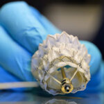 A photo of a heart valve implant developed by structural heart surgical robotics startup Capstan Medical.